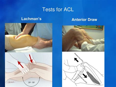 acl and pcl tear test|acl and pcl are intact.